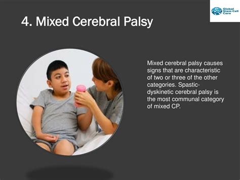 PPT Cerebral Palsy Stem Cell Treatment PowerPoint Presentation Free