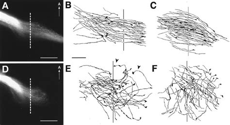 Patterns of RGC axon ingrowth in wild-type and GAP-43 homozygous null ...