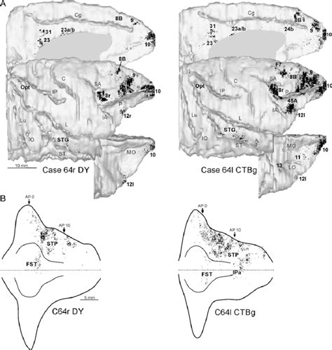 Distribution Of The Retrograde Labeling Observed In Cases 64r DY And 64