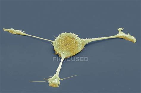 Fibroblast Cell Coloured Scanning Electron Micrograph Sem