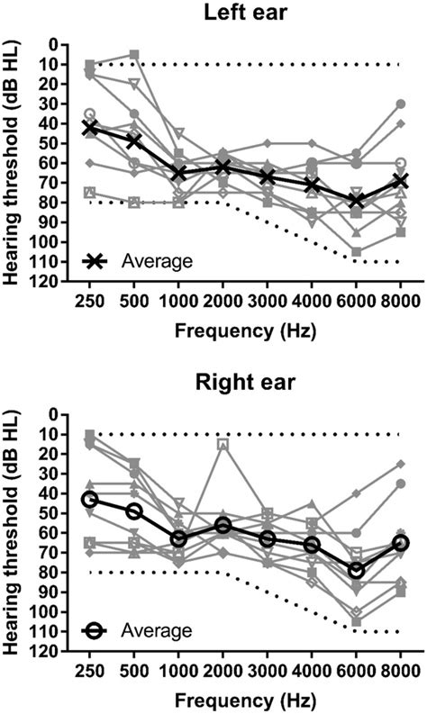 Audiograms For Left Upper Panel And Right Lower Panel Ears Grey Download Scientific