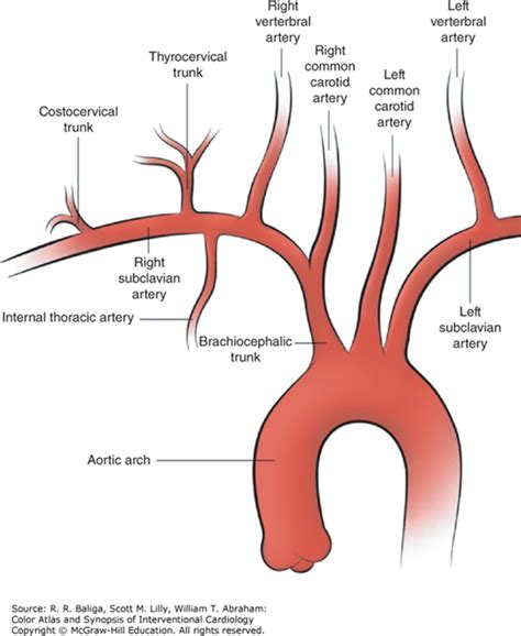 Subclavian Artery Diagram