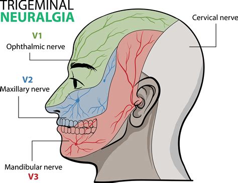 Trigeminal Nerve Branches Diagram Th Trigeminal Neuralgia | Sexiz Pix