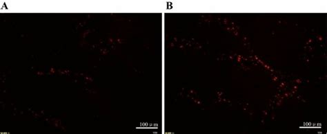 Frozen Sections Observed By Fluorescence Microscope All Images Are The