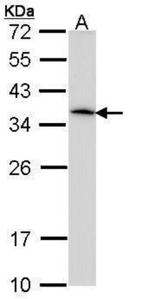 Hla Dra Polyclonal Antibody Invitrogen™ 100 μl Unconjugated Primary