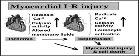 Exercise And Cardioprotection Current Opinion In Cardiology