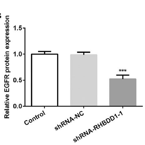 Knockdown Of Rhbdd Inhibits Egfr Akt Signaling Pathway In Renal Cell