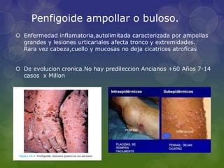 Penfigoide PPT