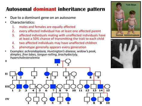 How To Identify Autosomal Dominant Pedigree