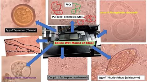 Procedure For Stool Parasite