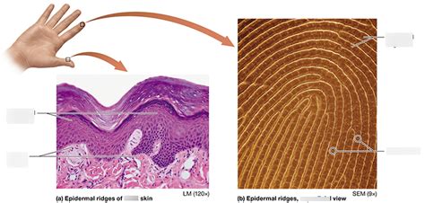 Epidermal Ridges make Fingerprints Diagram | Quizlet