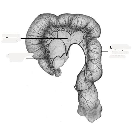 Inferior Mesenteric Artery Diagram Quizlet