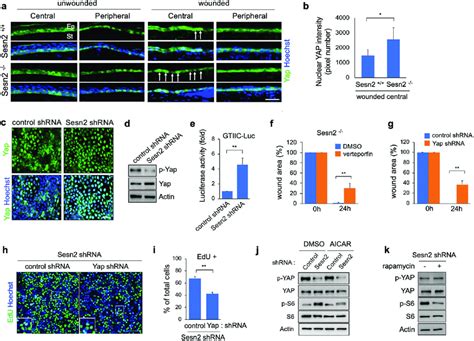 Sesn2 Negatively Regulates YAP Activity A Sections Of Injured And