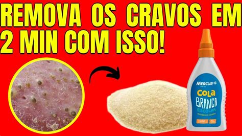 Como REMOVER CRAVOS do ROSTO ESSA RECEITA RÁPIDA YouTube