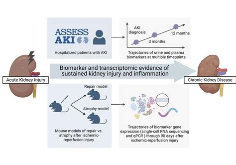 Study finds certain substances in urine, blood can predict kidney ...