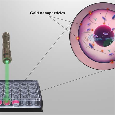 Schematic Illustration Of Gold Nanoparticle Photothermal Therapy In