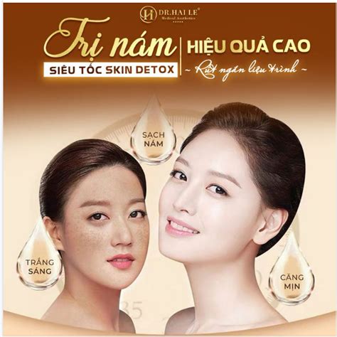 Hot hòn họt Trị nám nhận ưu đãi bất ngờ