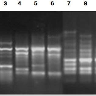 Representative Gel Showing Banding Profiles By Eric Pcr Analysis In