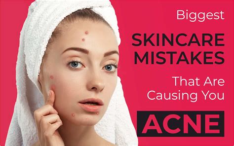 Biggest Skincare Mistakes That Are Causing You Acne