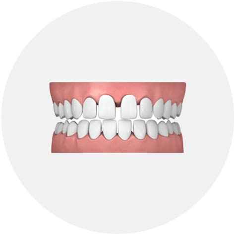 Common Orthodontic Treatments Jk Orthodontics Orthodontist El