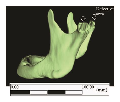 The patient’s jaw with condylar defect (a) and subsequently... | Download Scientific Diagram