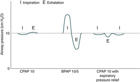 Positive Airway Pressure Treatment Neupsy Key