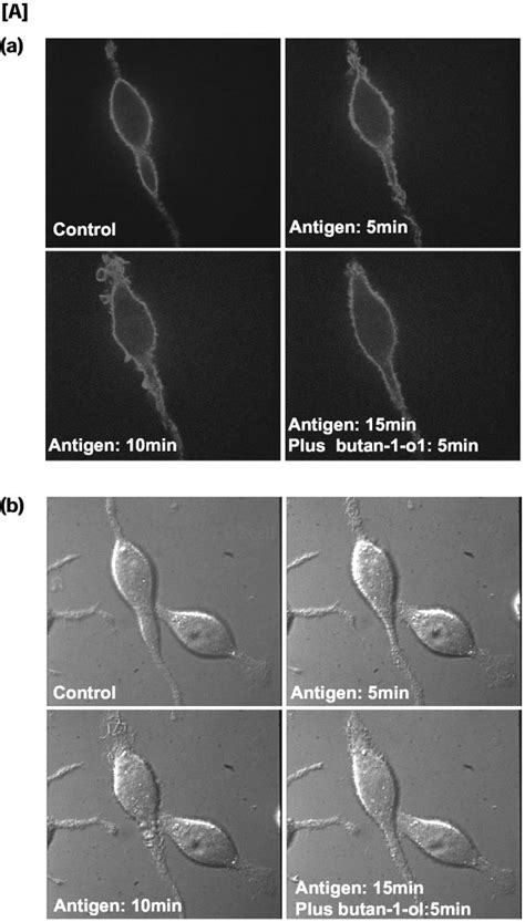 Membrane Ruffling In PLD2 Transfected Cells Is Sensitive To Inhibition