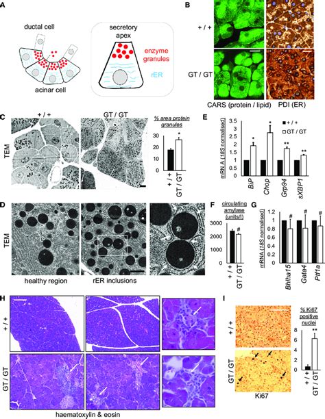 Loss Of Cell Polarization And Er Homeostasis And Consequent Tissue