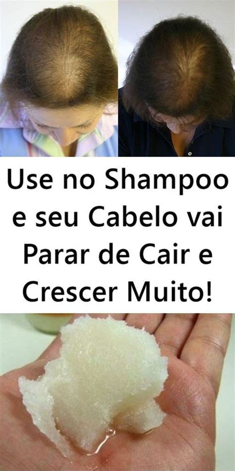 Use Isso No Shampoo E Seu Cabelo Vai Parar De Cair E Crescer Muito