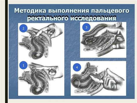 рак прямой кишки (1) - online presentation