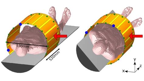 Radiation Transparent RF Coil Designed For MR Guidance Of Particle