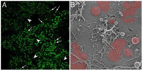 Morphology Of Clathrin Coated Structures At The Cell Surface A