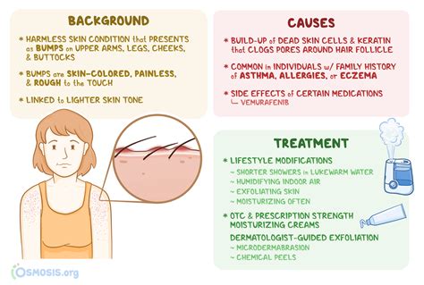 Keratosis Pilaris What Is It Causes Treatment And More Osmosis