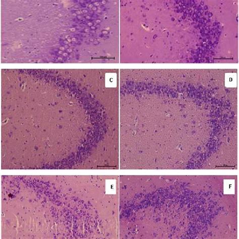 Cresyl Violet Stained Sections Of CA3 Of The Hippocampus A Saline