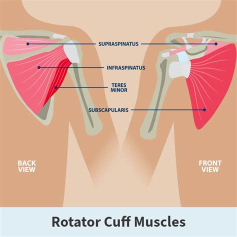 Rotator Cuff Tears Florida Orthopaedic Institute