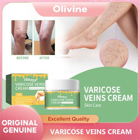 South Moon Varicose Veins Cream Venous Repair Cream Leg Massage