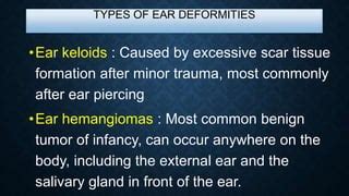 Deformities Of Ear PPT