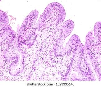 Mucosa Urinary Bladder Showing Transitional Epithelium Foto Stok