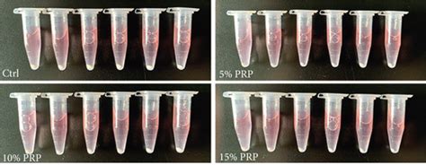 Gross Morphology Of Bmsc Pellets In Four Different Media After 3 Week