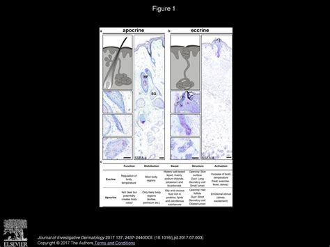 Stage Specific Embryonic Antigen 4 Ssea 4 As A Distinguishing Marker