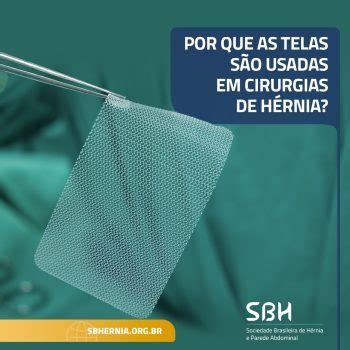 Por Que As Telas S O Utilizadas Em Cirurgias De H Rnia Sbh