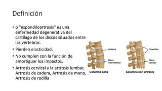 Artrosis De Columna Pptx