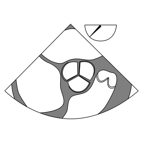 Mid Esophageal Aortic Valve Short Axis View Diagram Quizlet