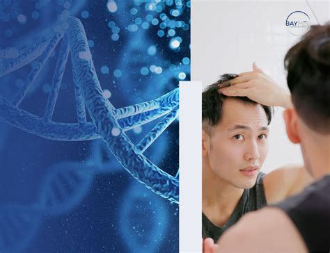 Genetic Testing For Hair Loss Discover The Advantages Baymed Hair