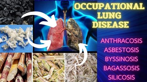 OCCUPATIONAL LUNG DISEASE Easiest Explanation With Notes YouTube