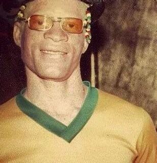 People Profile: King Yellowman - Jamaicans and Jamaica - Jamaicans.com