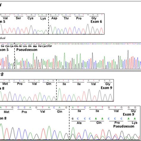 Electropherograms Showing CDNA Sequencing Analysis Of PCR Products