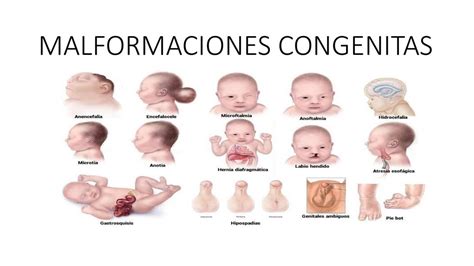 Desarrollo Del Sistema Endocrino Malformaciones Congenitas Porn Sex