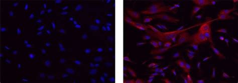 App Amyloid Precursor Protein Monoclonal Antibody 22c11 Efluor