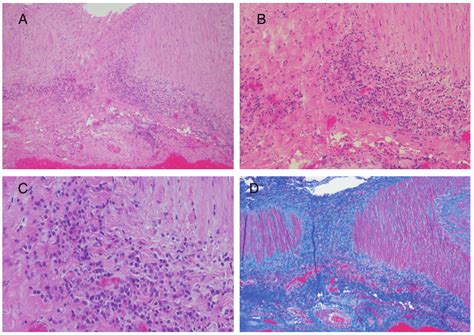 Photomicrographs Of Slides Fig 3a Photomicrograph H And E Stain X10 Download Scientific